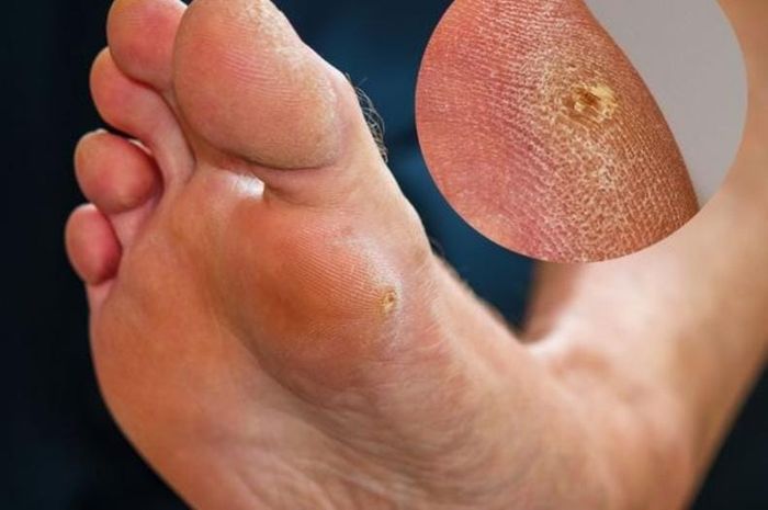 https://thefoot.org/wp-admin/post-new.php